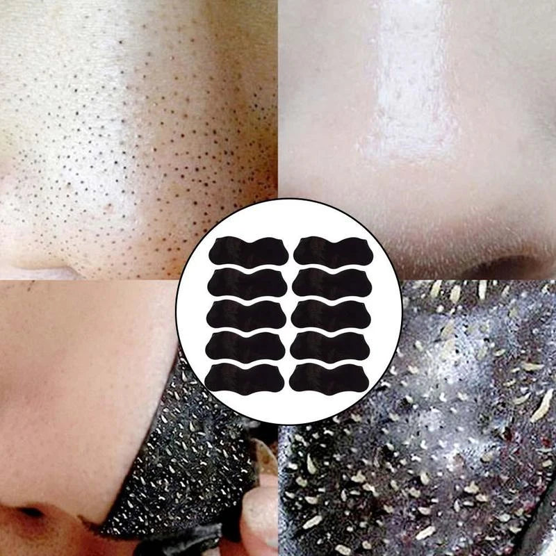 10pcs Nose Blackhead Remover Mask Deep Cleansing Skin Care Shrink Pore Acne Treatment Mask Nose Black dots Pore Clean Strips